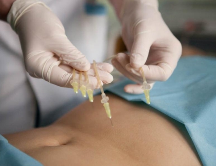 Озонотерапия - Оздоровительные услуги - Отель Alean Family Sputnik / Алеан Фэмили Спутник 